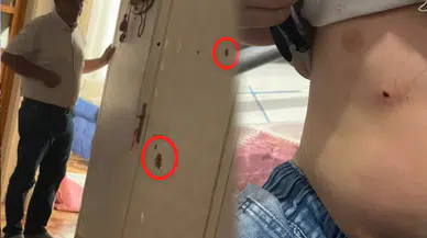 Silvan’da silahlı kavga: Çocuklar arasında kanlı çatışma