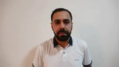 Diyarbakır'da burun estetiği sonrası kabusu yaşayan Mazlum İlik hastaneye dava açtı