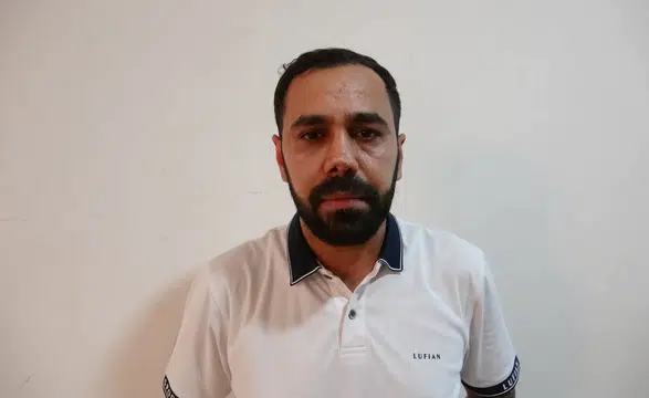 Diyarbakır'da burun estetiği sonrası kabusu yaşayan Mazlum İlik hastaneye dava açtı