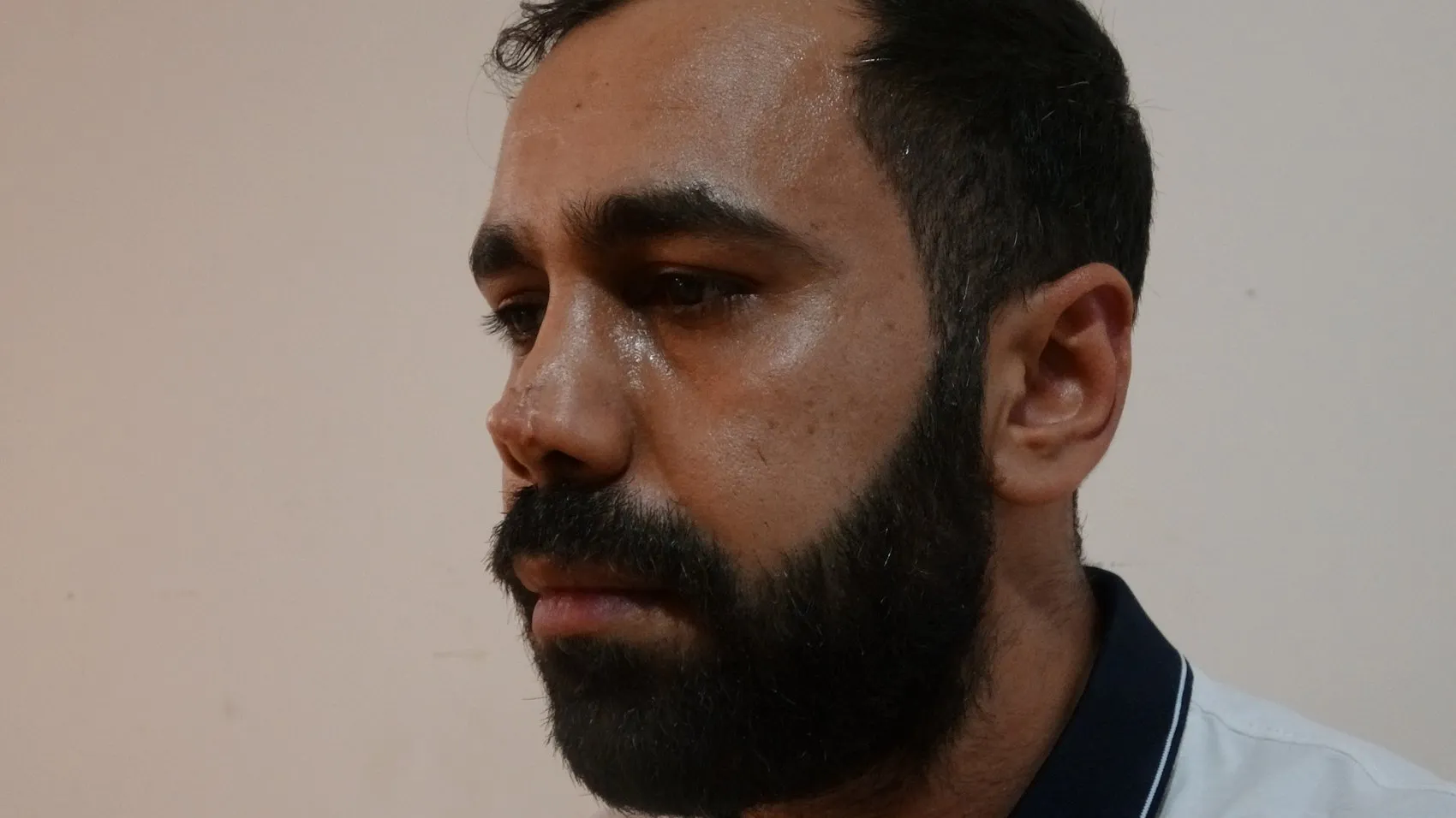 Diyarbakır'da burun estetiği sonrası kabusu yaşayan Mazlum İlik hastaneye dava açtı