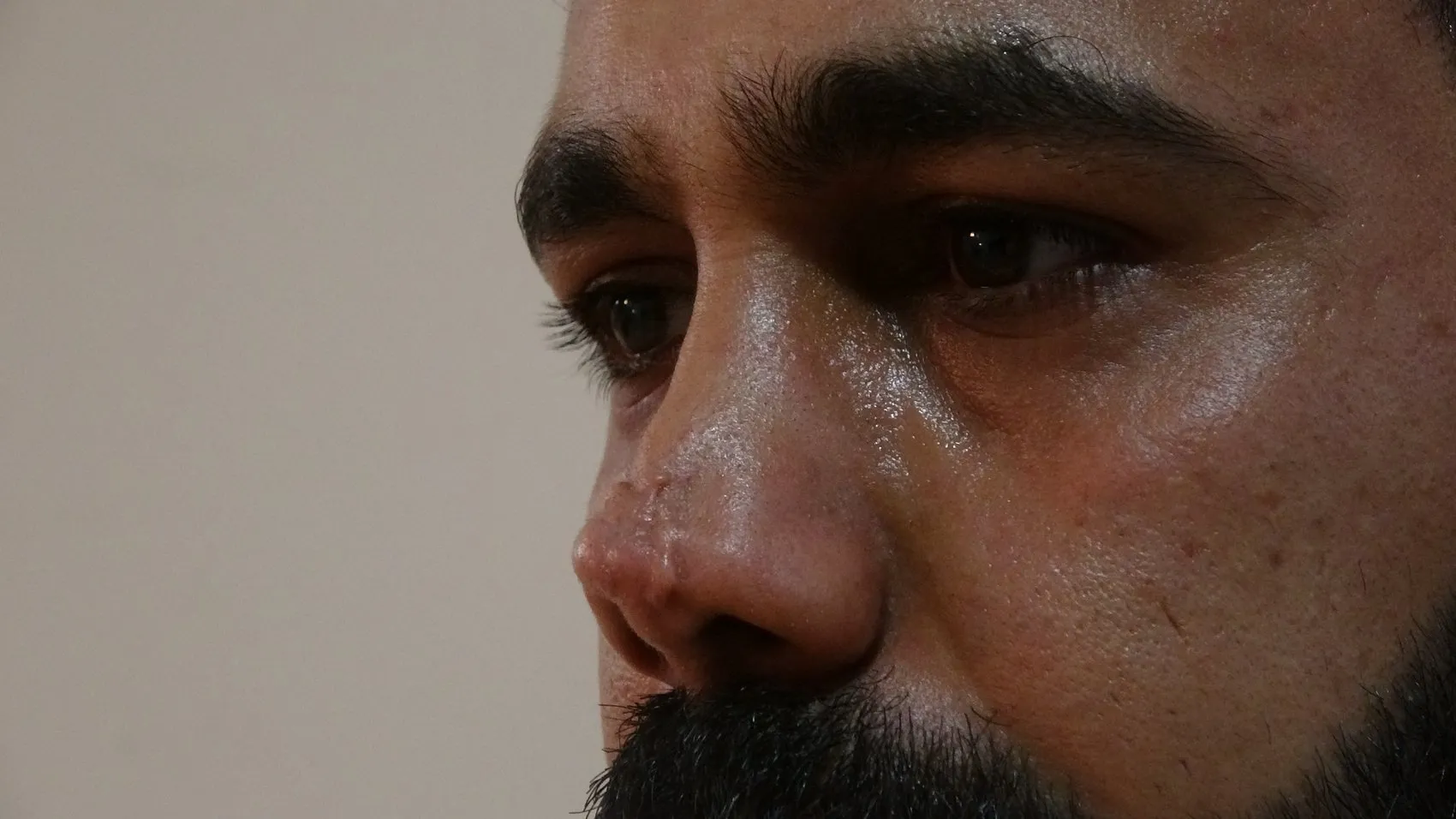 Diyarbakır'da burun estetiği sonrası kabusu yaşayan Mazlum İlik hastaneye dava açtı