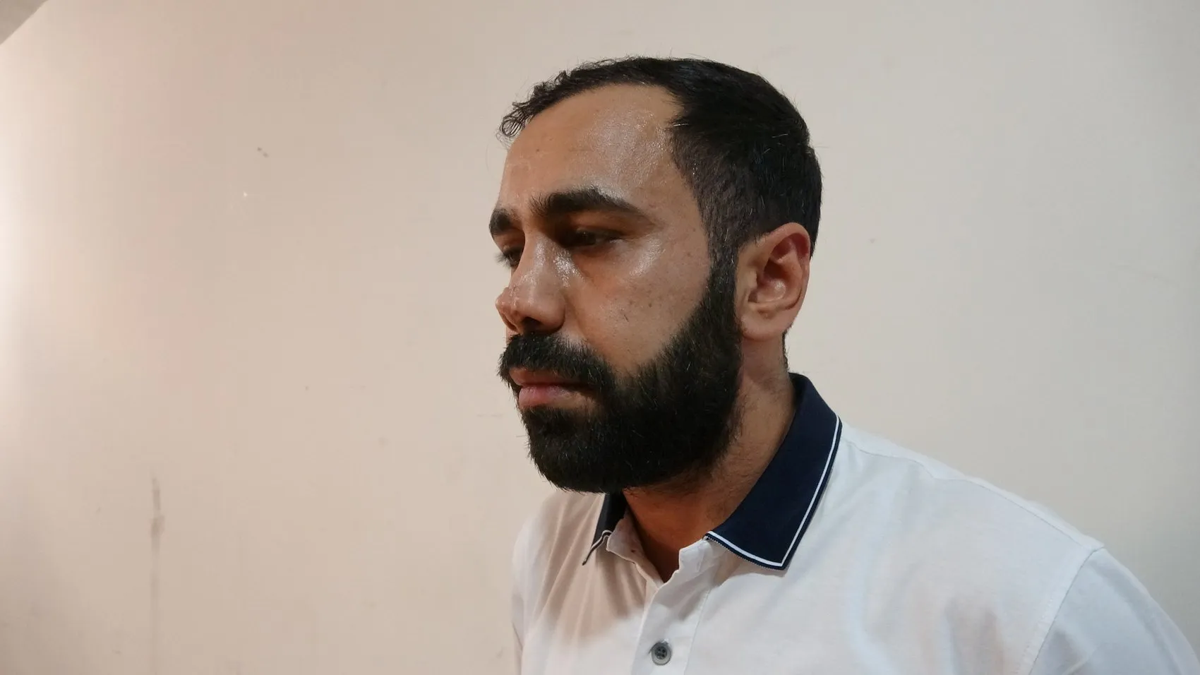 Diyarbakır'da burun estetiği sonrası kabusu yaşayan Mazlum İlik hastaneye dava açtı